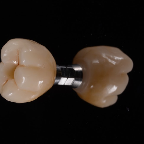 Foto Enric Pintado Cl�nica Dental