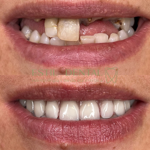 Foto Estil Dental Mollerussa