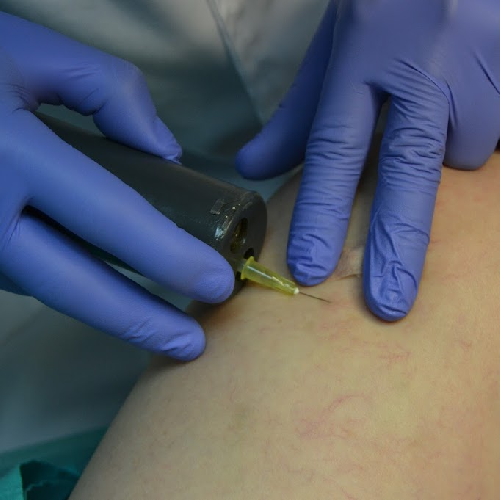 Foto Centro de Estudios Vasculares