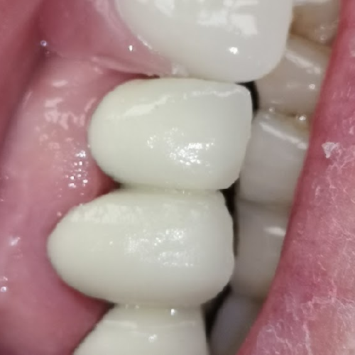 Foto Cl�nicas Dentalia