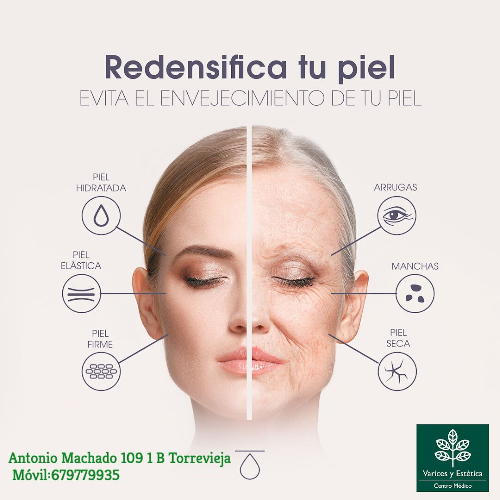 Foto Varices y Est�tica