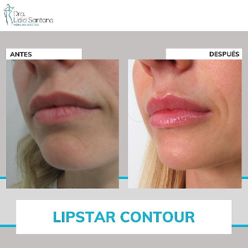 Foto Medicina Estetica Dra. Lidici Santana