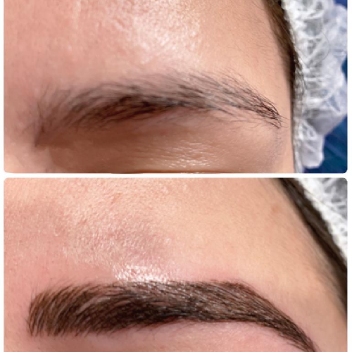 Foto Romano Micropigmentaci�n y Est�tica