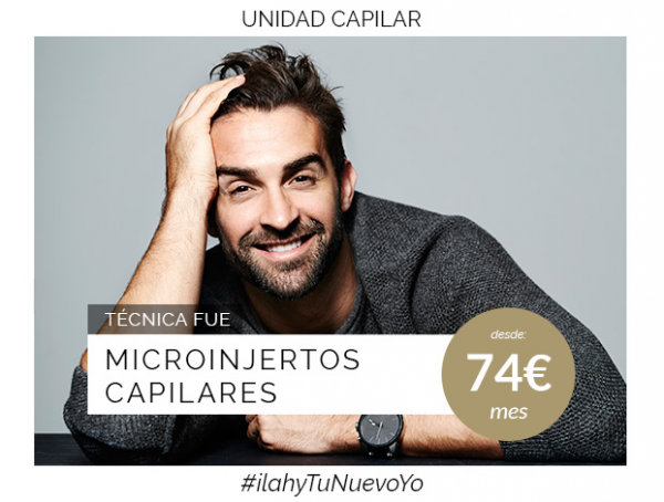 Microinjertos capilares en TodoEstetica.com