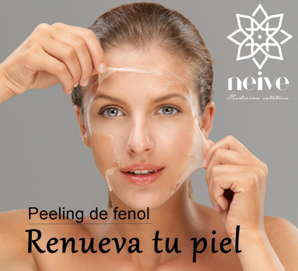 Peeling de fenol en TodoEstetica.com