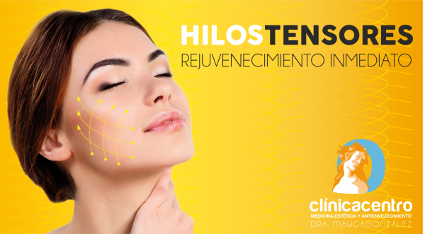 LIFTING SIN CIRUGA - HILOS TENSORES en TodoEstetica.com