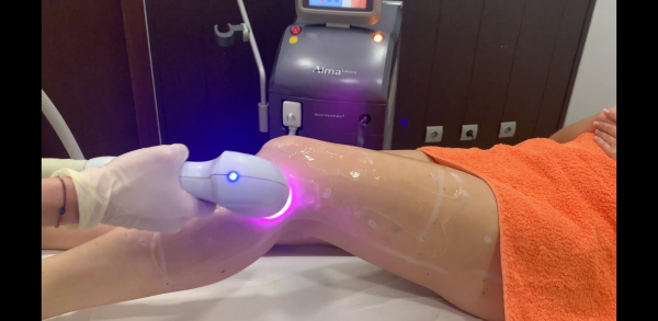 Depilaci�n M�dica L�ser al 60 % de descuento en Cl�nicas DH en TodoEstetica.com