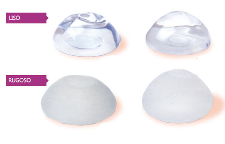 Preguntas frecuentes sobre las pr�tesis mamarias