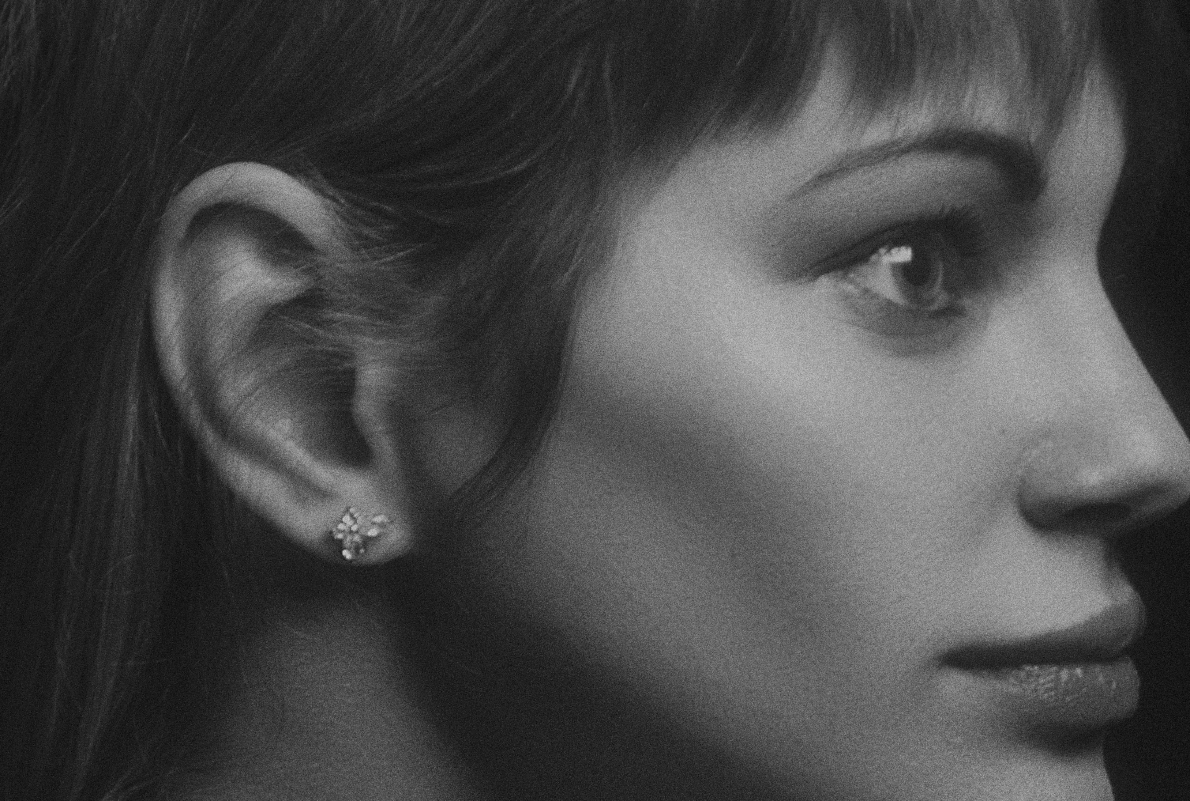 Mis orejas no me gustan. �En qu� casos se puede hacer una otoplastia?