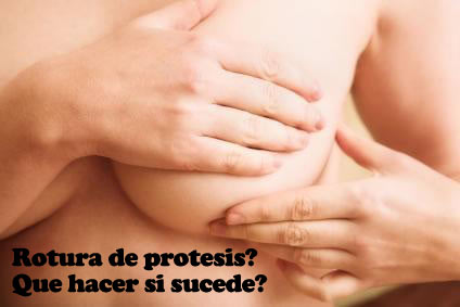 Problemas por rotura de pr�tesis y perdida de silicona