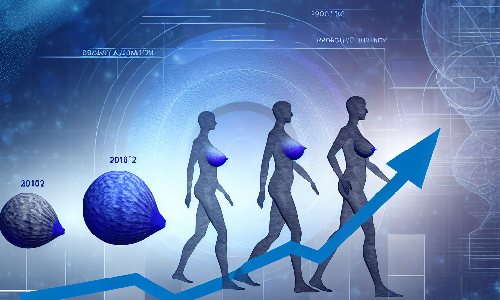 Tendencias Evolutivas en la Aumentación Estética de Senos: Nuevos Datos | Wolters Kluwer