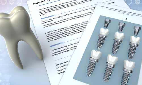 Colocacin de Implantes Dentales y sus Resultados Clnicos: Estudio Exhaustivo