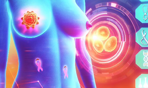 Nuevo estudio revela mejoras significativas en reconstrucciones mamarias post-radioterapia
